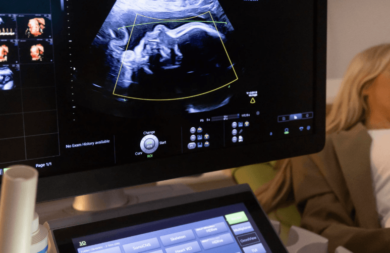 Detaylı Ultrason (Anomali Taraması) Nedir?